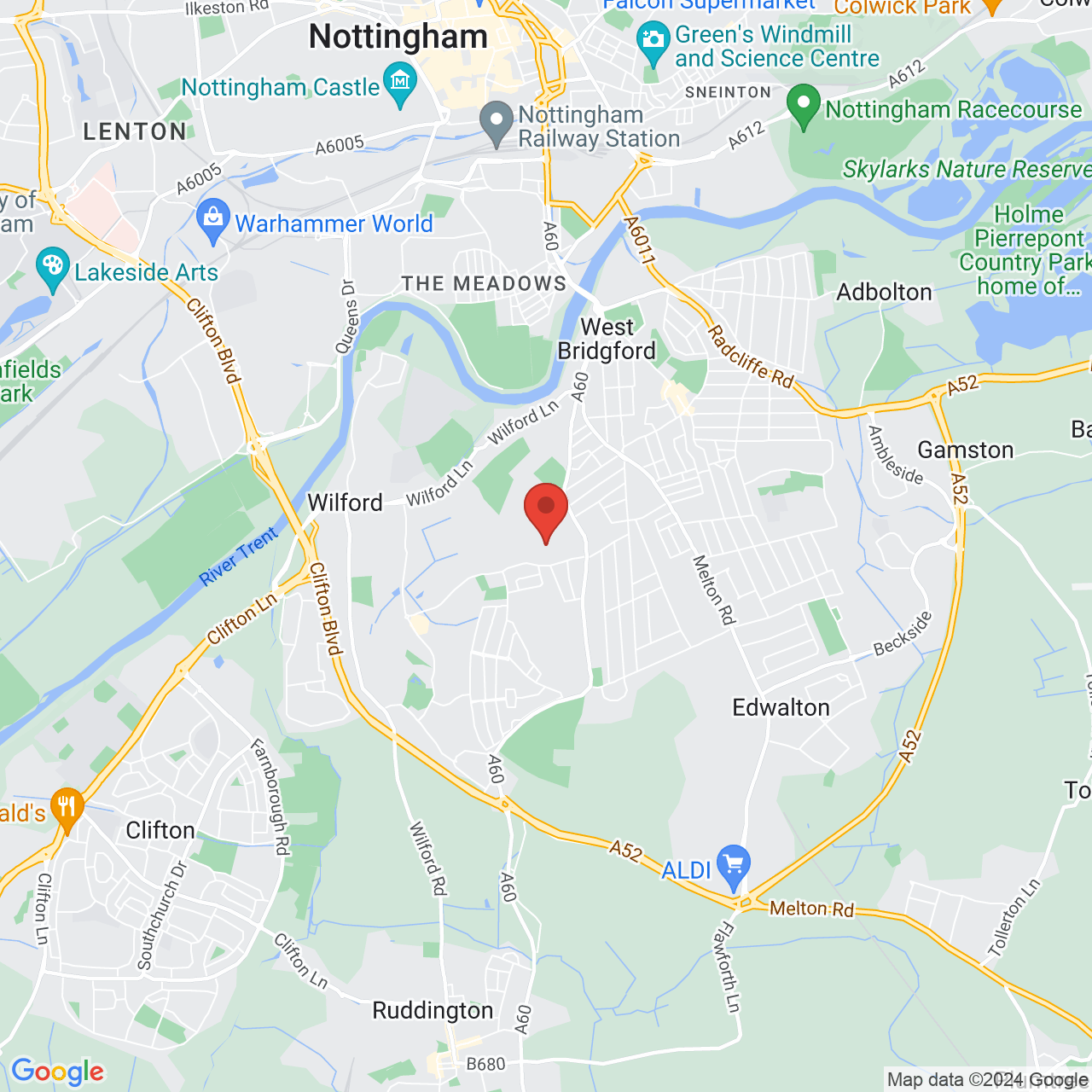 Asda Jobs Vacancy Mobile Contact Lens Optician, Nottingham